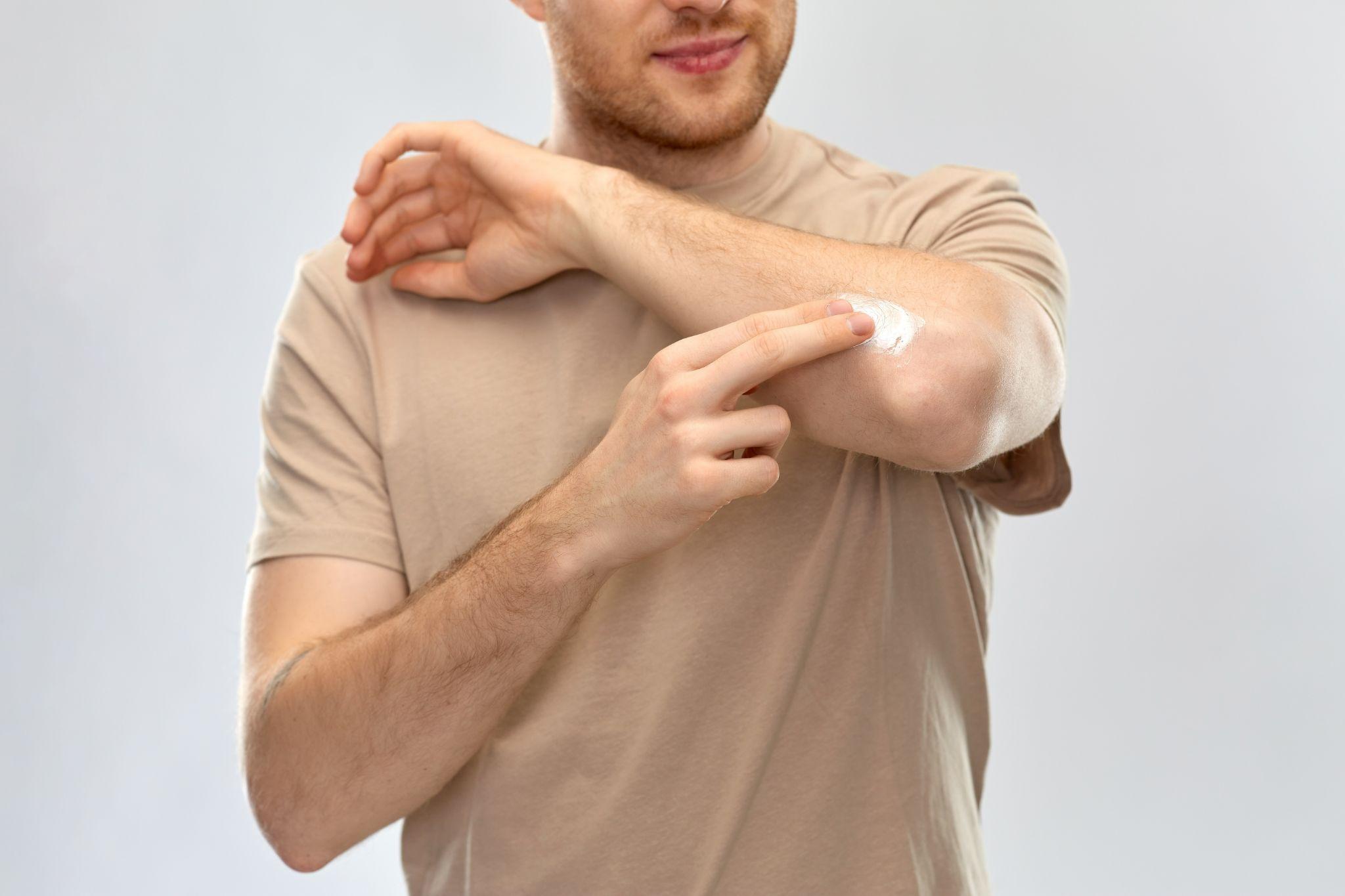 health problem and people concept - young man applying pain medication or moisturizing cream to his elbow